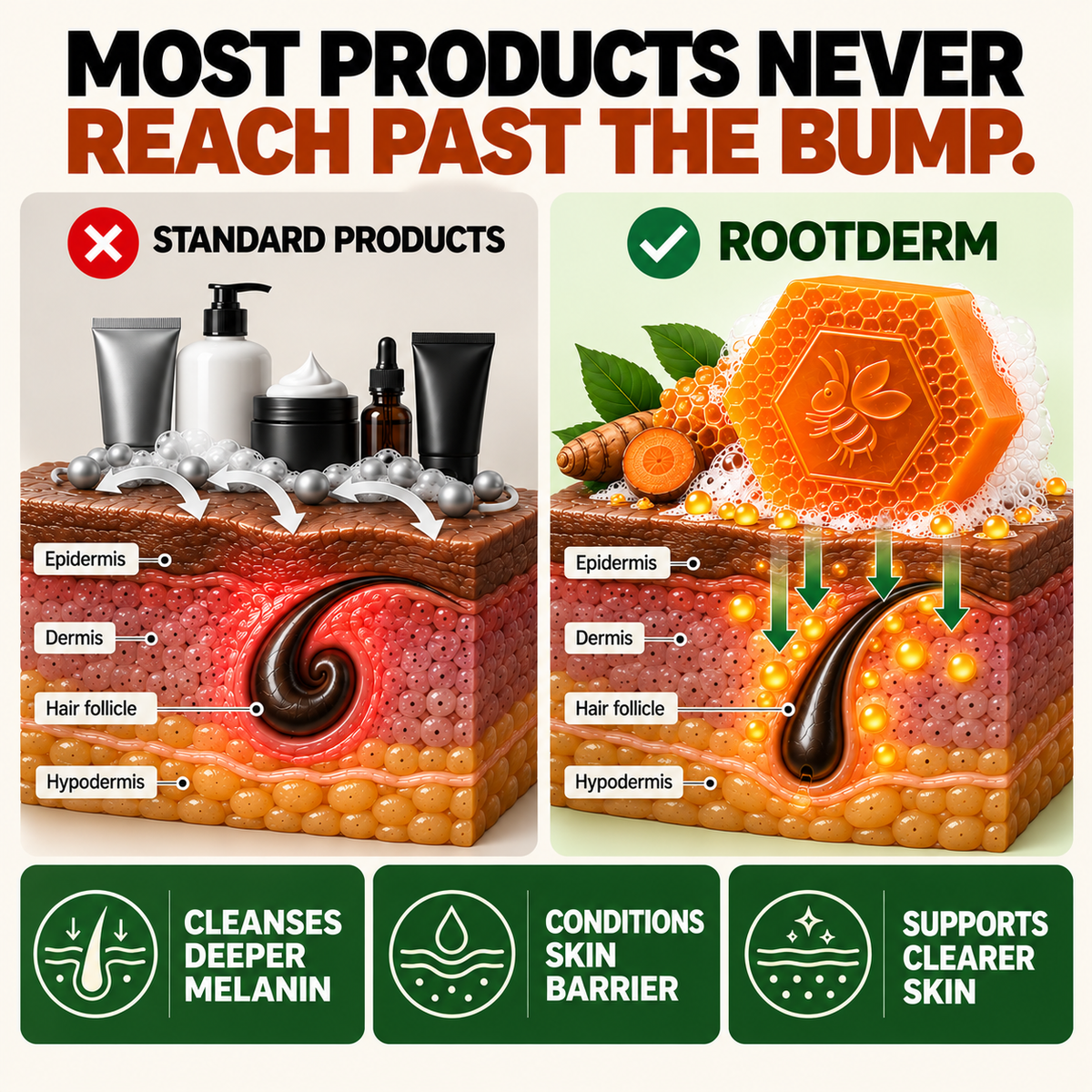 RootDerm Turmeric + Honey Bar