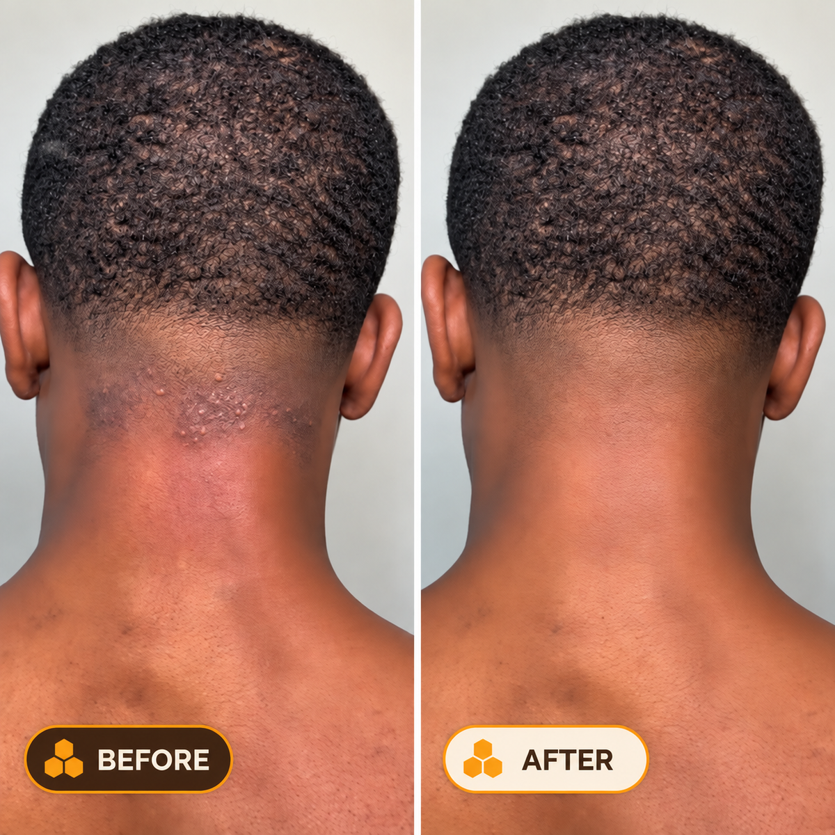 RootDerm Turmeric + Honey Bar